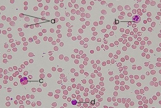 Normal blood (only b and c are granulocytes) Photo by Department of Histology, Jagiellonian University Medical College